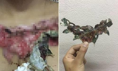 洗纹身的惨痛代价！选择好的刺符师傅到底有多重要？！【泰国佛牌】