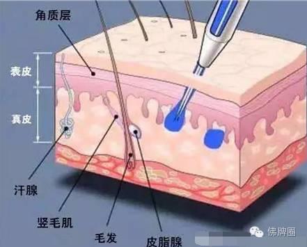 纹身刺符到底有多疼？一张图告诉你任意疼痛感。-图片1