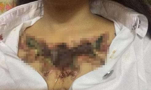 洗纹身的惨痛代价！选择好的刺符师傅到底有多重要？！【泰国佛牌】