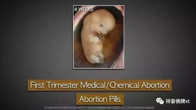 首部反堕胎电影《一念》慈悲开演！(转发功德无量）-图片3