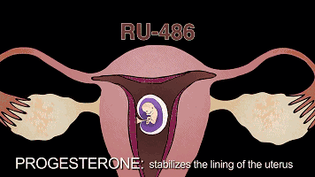 首部反堕胎电影《一念》慈悲开演！(转发功德无量）-图片5