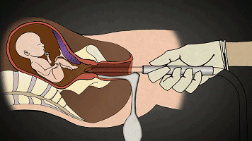 【惨绝人寰的堕胎手术】【泰国佛牌】