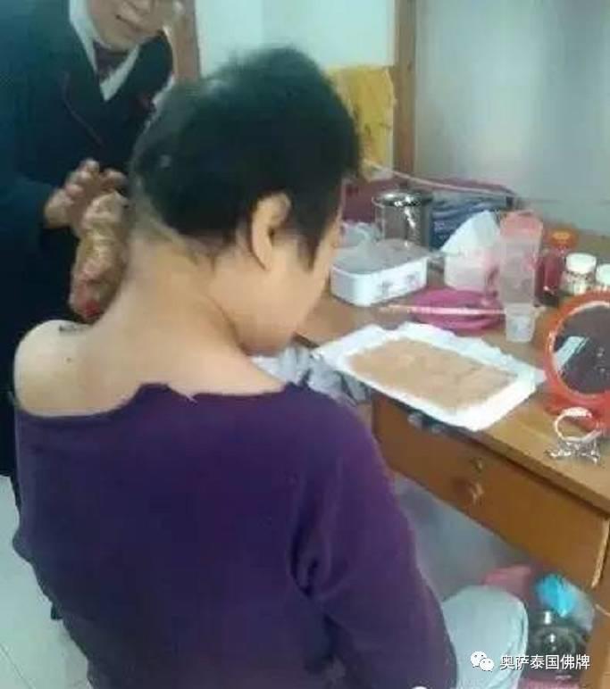 打蛇堕胎后颈部长巨瘤,又像婴儿又像蛇(附多张照片)【泰国佛牌】 打蛇堕胎后颈部长巨瘤,又像婴儿又像蛇(附多张照片)-图片8
