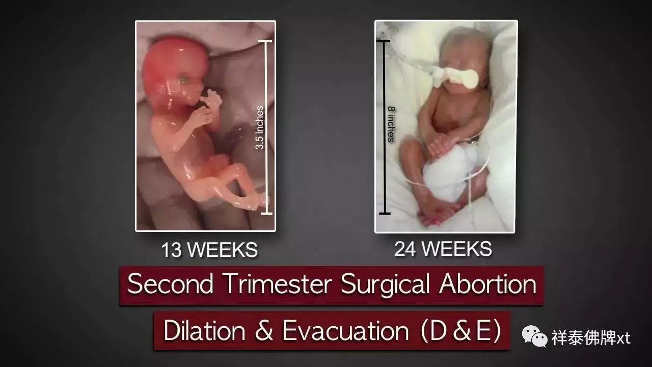 首部反堕胎电影《一念》慈悲开演！(转发功德无量）-图片15