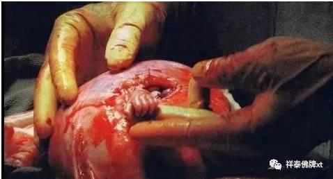 堕胎之与业障-图片7