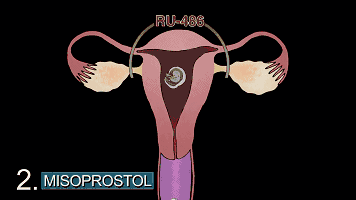 【惨绝人寰的堕胎手术】【泰国佛牌】