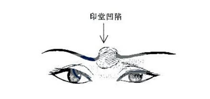 不吉利的印堂面相！不可大意！-图片4