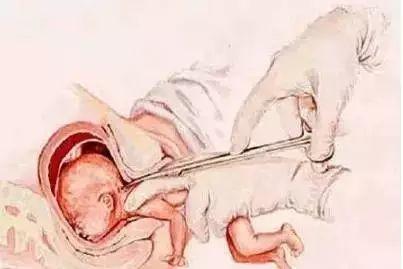 你若堕胎……（可投票）-图片3