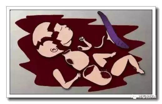 监控居然拍到了！堕胎婴灵跟随妈妈离去，请再爱一次那曾被伤害的小生命！