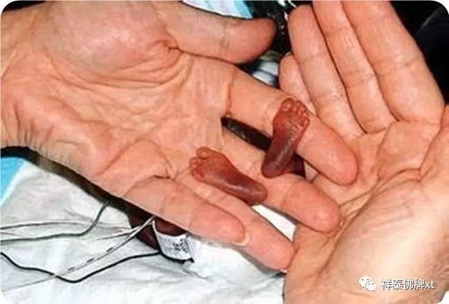 首部反堕胎电影《一念》慈悲开演！(转发功德无量）-图片2