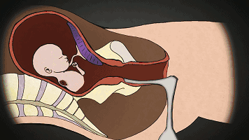 首部反堕胎电影《一念》慈悲开演！(转发功德无量）-图片18
