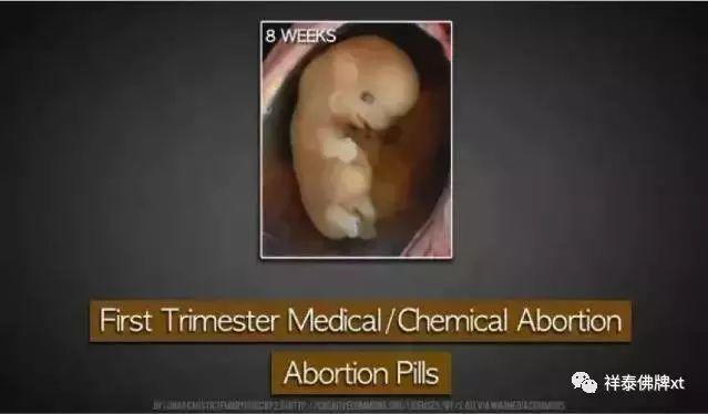 为什么一定为什么一定要戴套？血淋淋的事实，都看看吧！！！要戴套？血淋淋的事实，都看看吧！！！-图片3