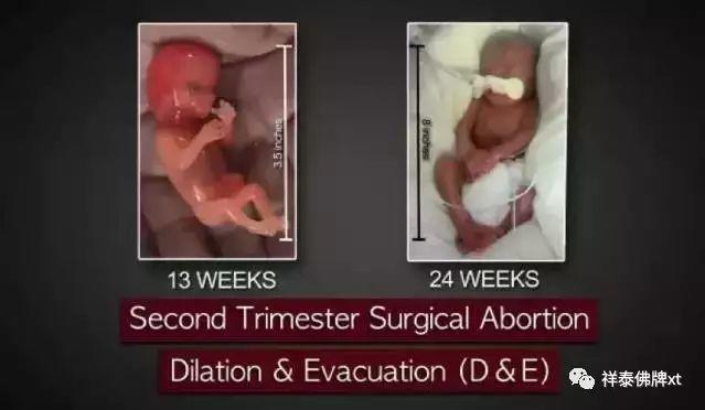 为什么一定为什么一定要戴套？血淋淋的事实，都看看吧！！！要戴套？血淋淋的事实，都看看吧！！！-图片12