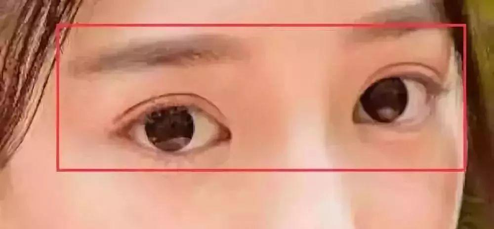 眼睛看相：观其眼相识人运势高低-图片10