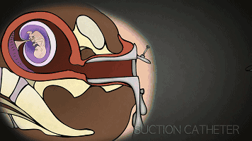 首部反堕胎电影《一念》慈悲开演！(转发功德无量）-图片13