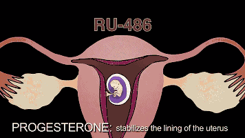 为什么一定为什么一定要戴套？血淋淋的事实，都看看吧！！！要戴套？血淋淋的事实，都看看吧！！！-图片5