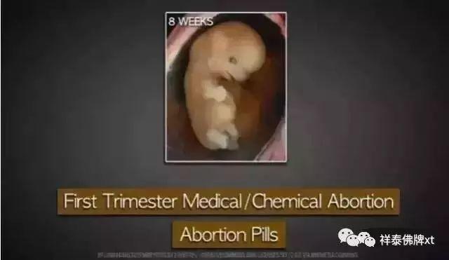 【惨绝人寰的堕胎手术】【泰国佛牌】 【惨绝人寰的堕胎手术】-图片6