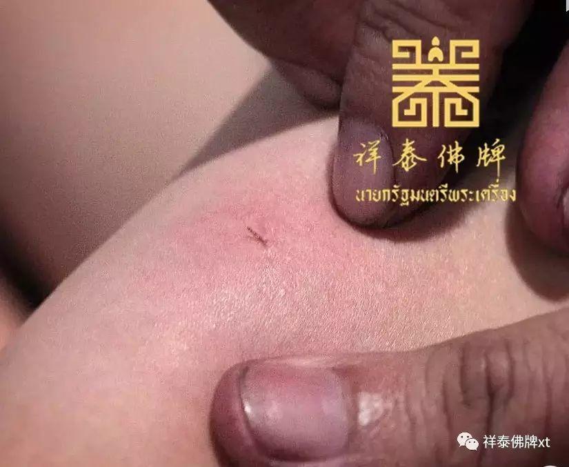 【 金针 】-图片2