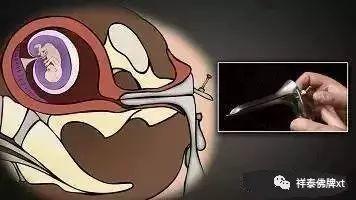 【惨绝人寰的堕胎手术】【泰国佛牌】 【惨绝人寰的堕胎手术】-图片7