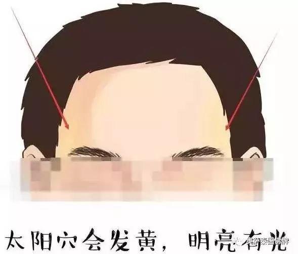 太准了！额头上出现这几种征兆，预示马上翻身转运或一夜暴富！-图片1