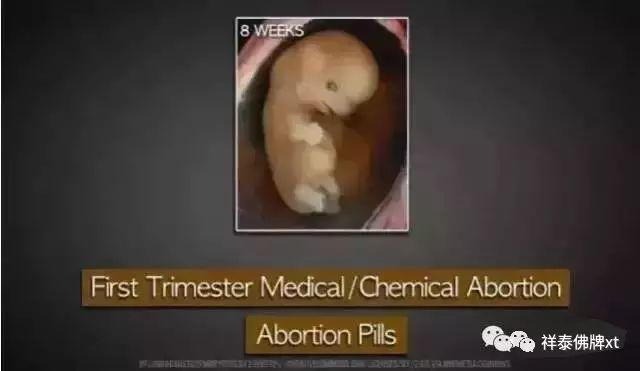 【惨绝人寰的堕胎手术】【泰国佛牌】 【惨绝人寰的堕胎手术】-图片3
