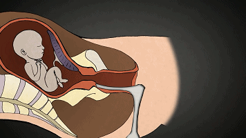 【惨绝人寰的堕胎手术】【泰国佛牌】