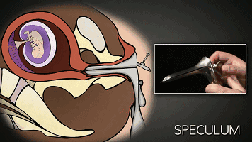 为什么一定为什么一定要戴套？血淋淋的事实，都看看吧！！！要戴套？血淋淋的事实，都看看吧！！！-图片8