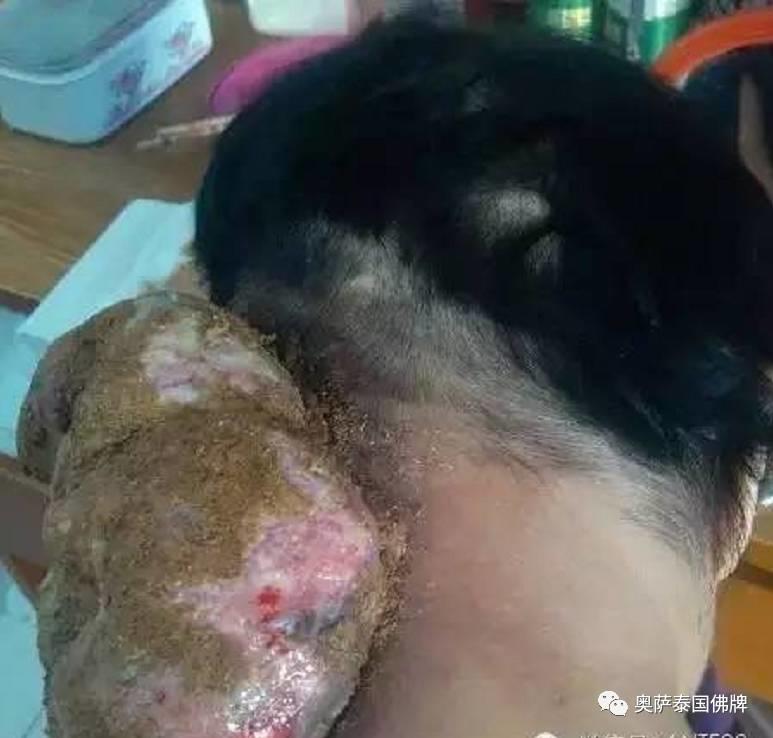 打蛇堕胎后颈部长巨瘤,又像婴儿又像蛇(附多张照片)【泰国佛牌】 打蛇堕胎后颈部长巨瘤,又像婴儿又像蛇(附多张照片)-图片6