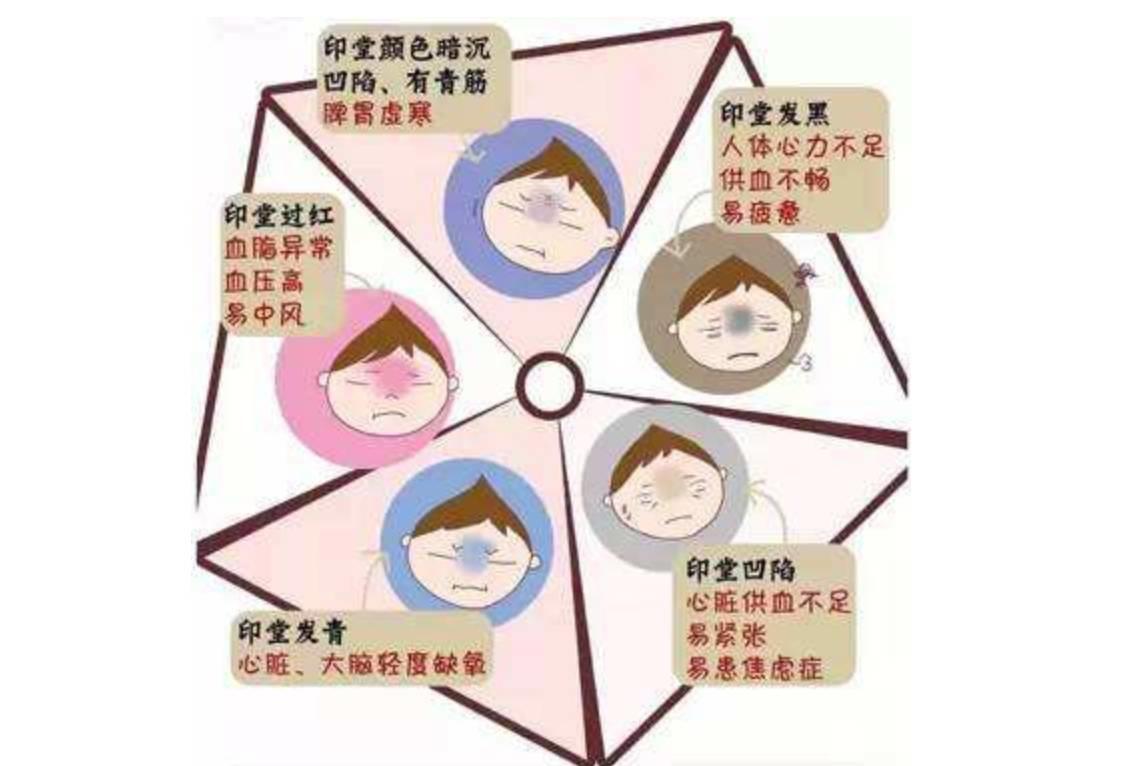 不吉利的印堂面相！不可大意！-图片6