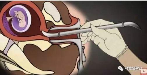 首部反堕胎电影《一念》慈悲开演！(转发功德无量）-图片11