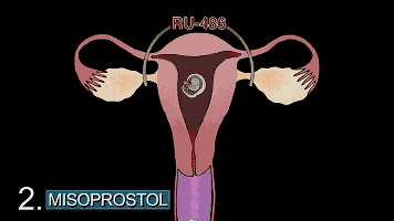 为什么一定为什么一定要戴套？血淋淋的事实，都看看吧！！！要戴套？血淋淋的事实，都看看吧！！！-图片6