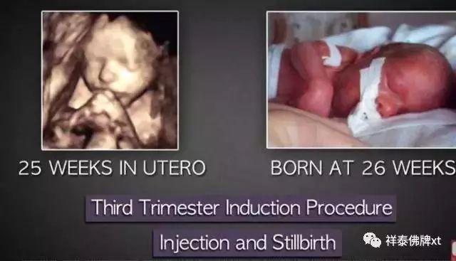 首部反堕胎电影《一念》慈悲开演！(转发功德无量）-图片20