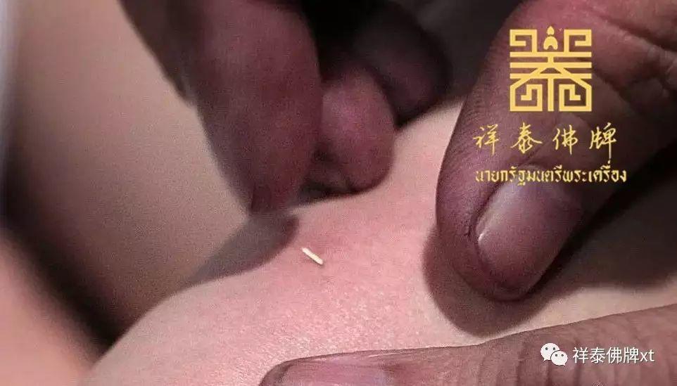 【 金针 】-图片3