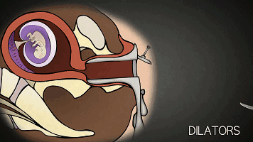 为什么一定为什么一定要戴套？血淋淋的事实，都看看吧！！！要戴套？血淋淋的事实，都看看吧！！！-图片9