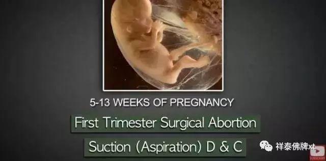 首部反堕胎电影《一念》慈悲开演！(转发功德无量）-图片9