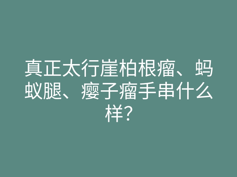 真正太行崖柏根瘤、蚂蚁腿、瘿子瘤手串什么样?